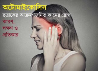 doinik-otomicosis-Fungal ear disease