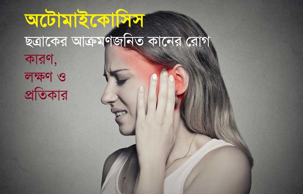 doinik-otomicosis-Fungal ear disease